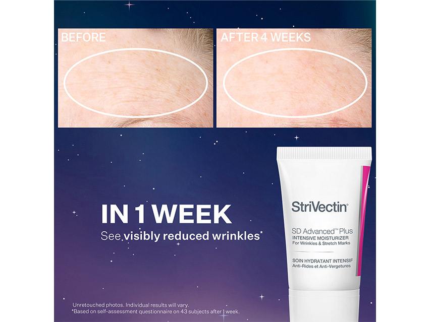 StriVectin Smooth &amp; Plump Anti-Wrinkle Set - Limited Edition