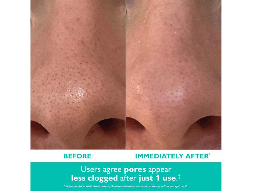 Peter Thomas Roth Even Smoother Microdermabrasion Exfoliating Pore Treatment