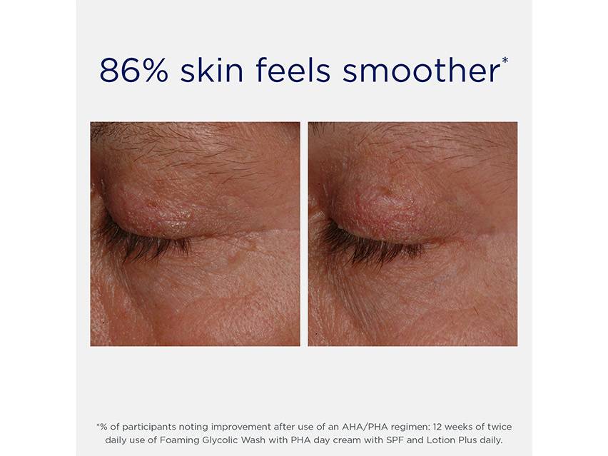 NEOSTRATA Resurface Lotion Plus