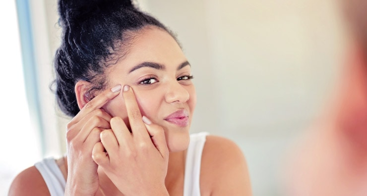 Why Pimples Pop Up in the Same Spot | LovelySkin™