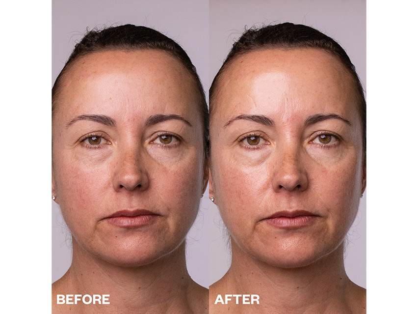 Wrinkles Schminkles Polishing Peel Pads