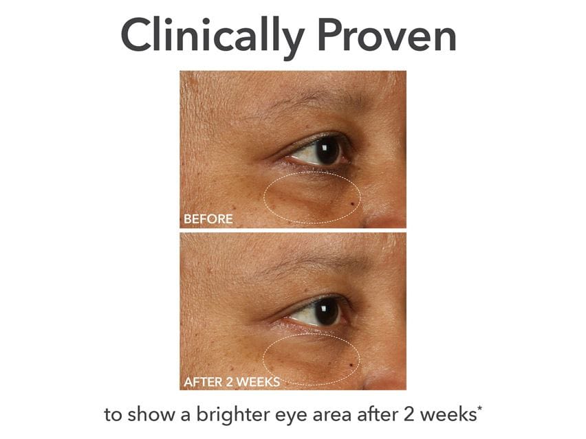 Dr. Dennis Gross DermInfusions Fill + Repair Eye Cream