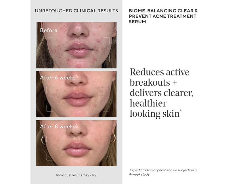 Murad Biome-Balancing Clear &amp; Prevent Acne Treatment Serum