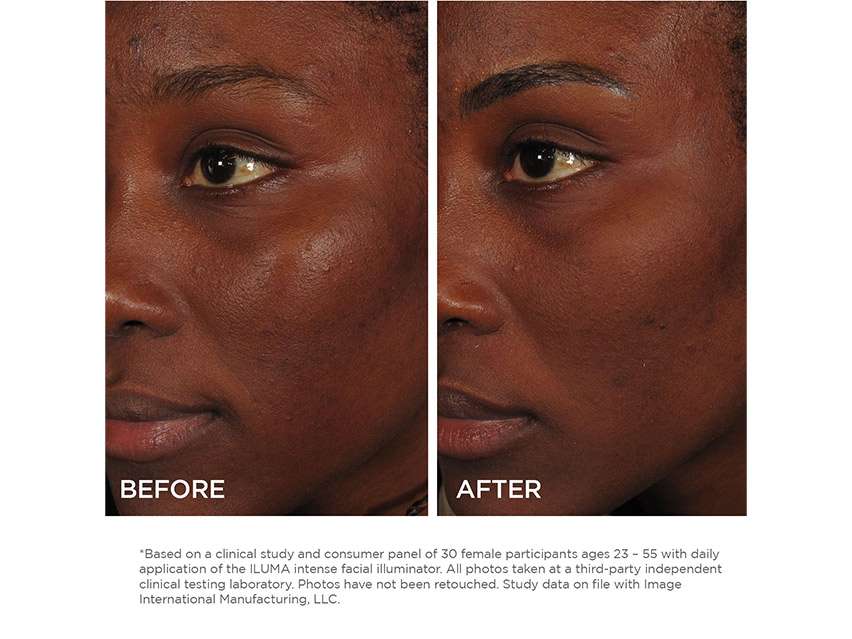 IMAGE Skincare ILUMA Intense Facial Illuminator