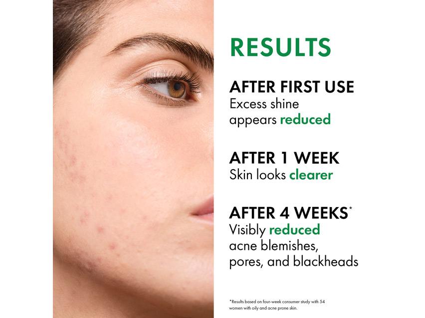 Vichy Normaderm PhytoAction Daily Deep Cleansing Gel