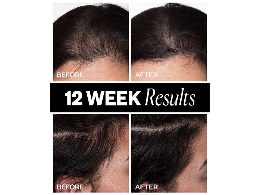 IGK Sponsored Hair Density Scalp Treatment