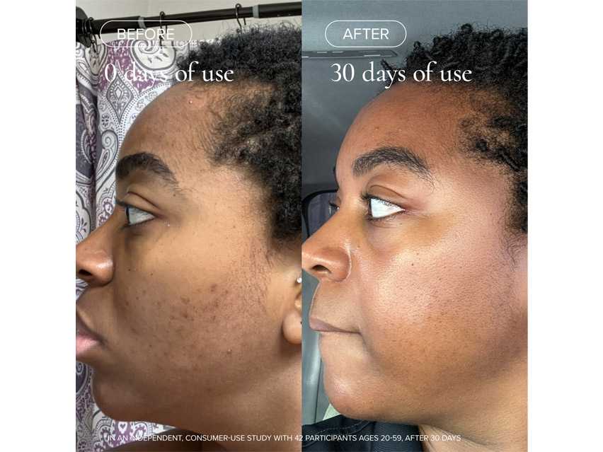 MARA Clear Skin Mineral Milk Acne Treatment