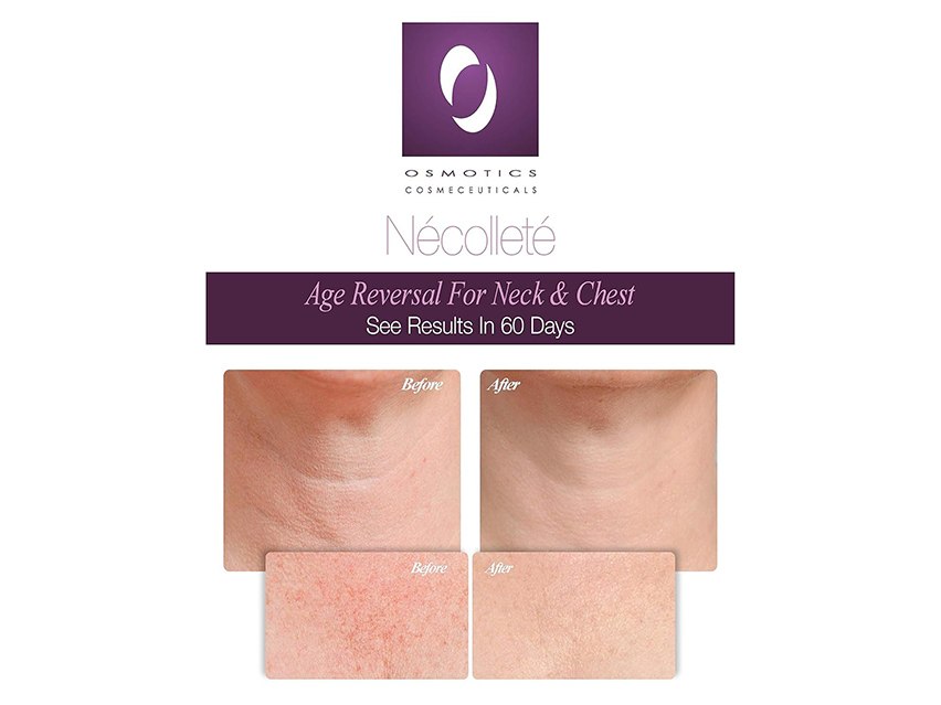 Osmotics Necollete Age Reversal for Neck and Chest