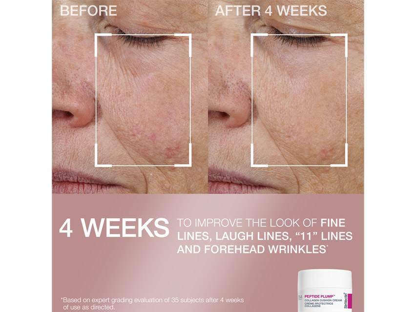 StriVectin Clinically Proven Minis - Limited Edition
