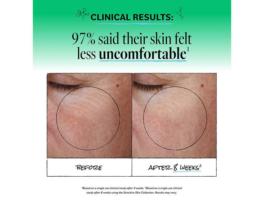 derma e Sensitive Skin Serum