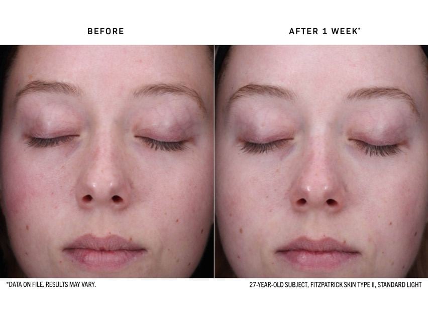 Revision Skincare Radiance+ Resurfacing Serum