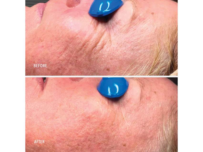 HydroPeptide Collagen ReActivate PM