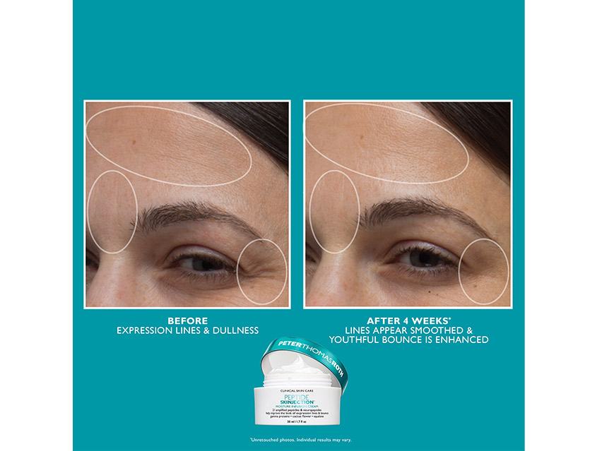 Peter Thomas Roth Peptide Skinjection Solutions Set - Limited Edition