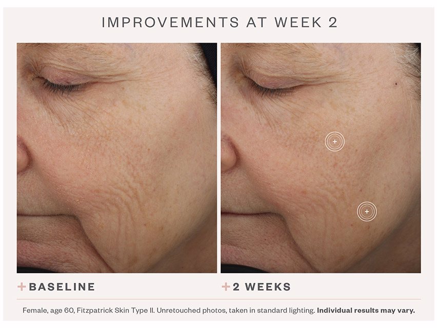 Before and After Photos for SkinMedica TNS Advanced+ Serum