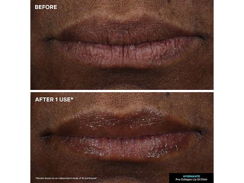 Kate Somerville HydraKate Lip Oil Elixir