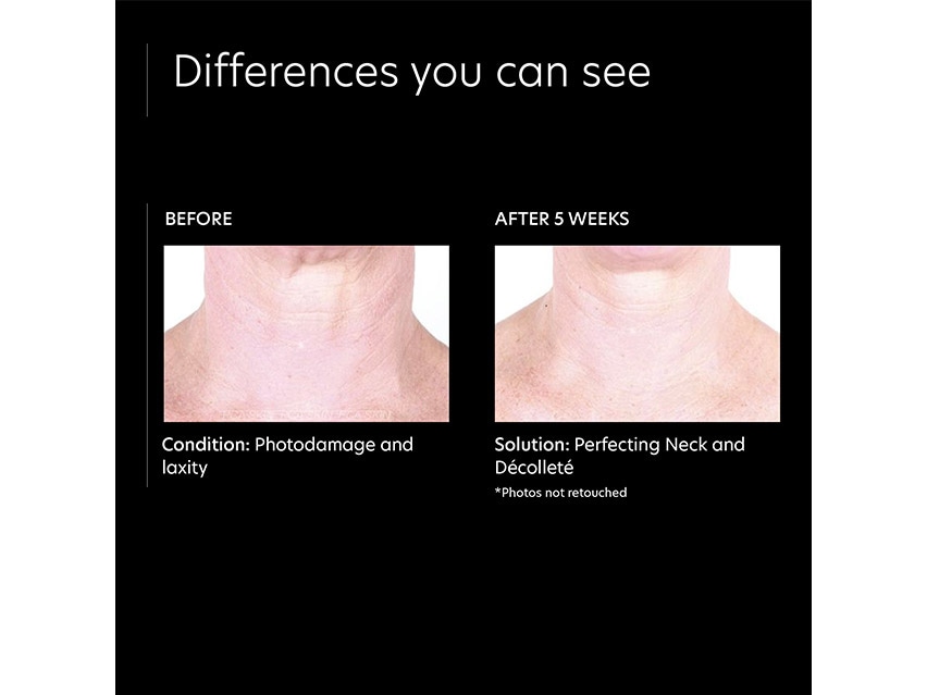 PCA SKIN Perfecting Neck and Decollete