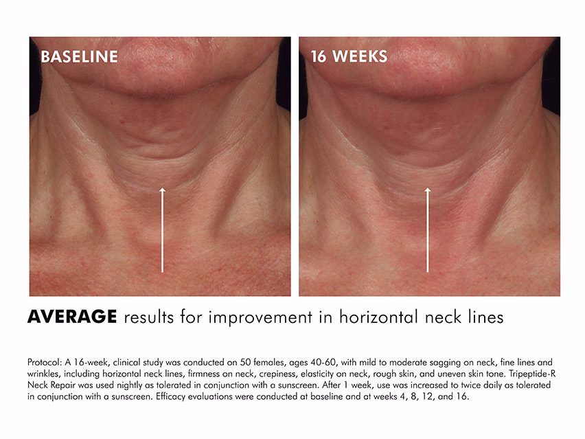 neck repair skinceuticals