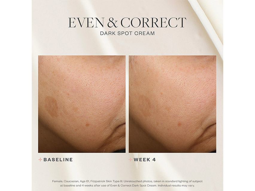 SkinMedica Even &amp; Correct Dark Spot Cream