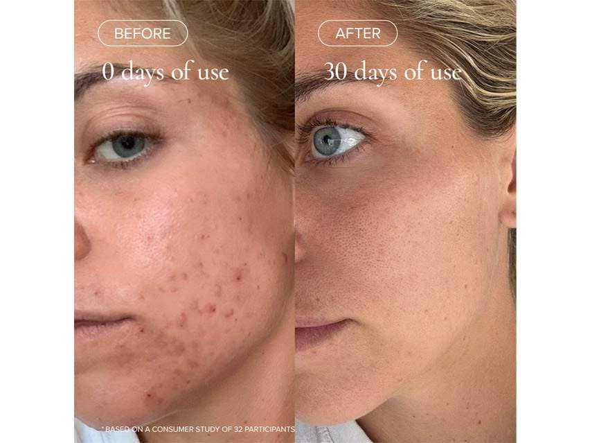 MARA Flower Acid Algae Serum