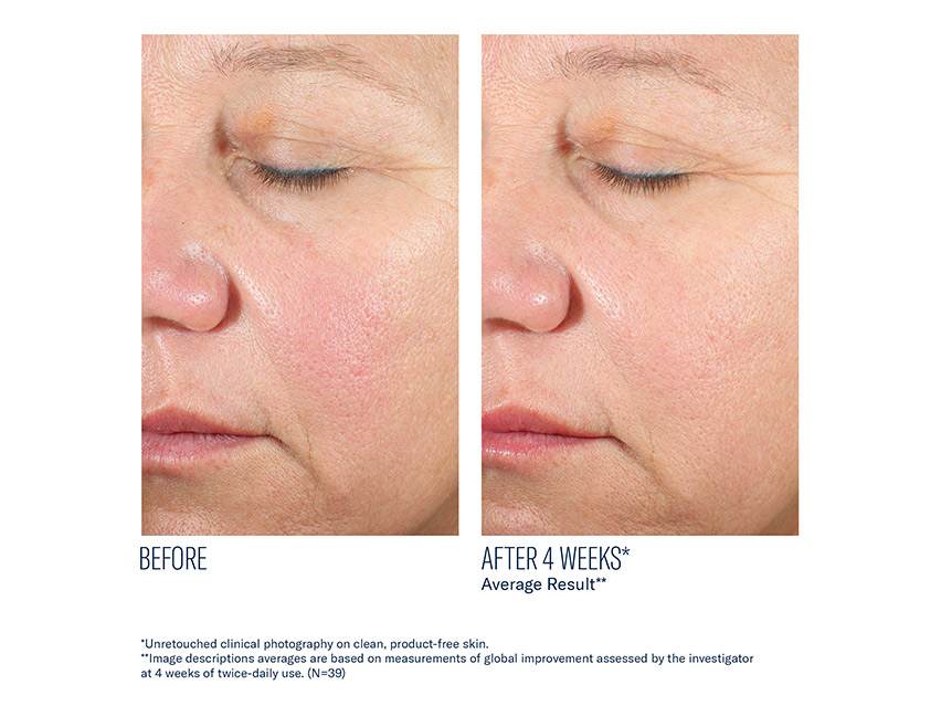 skinbetter science Alto Advanced Defense and Repair Serum