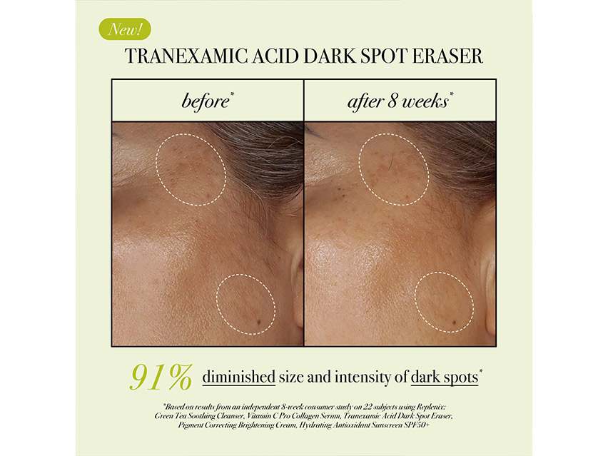 Replenix Tranexamic Acid Dark Spot Corrector