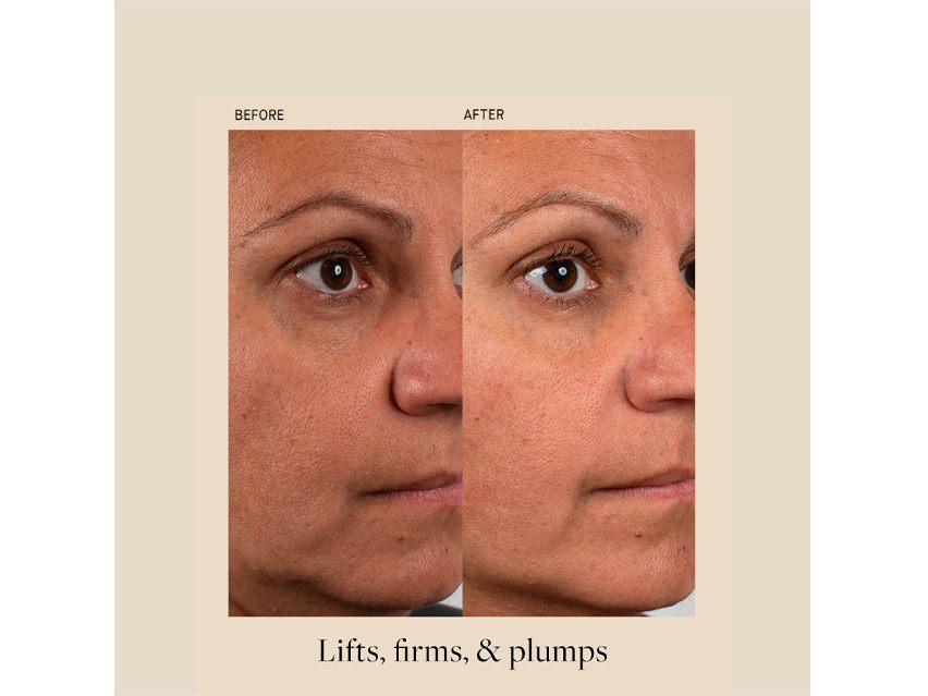 Kat Burki Amino Protein Mask