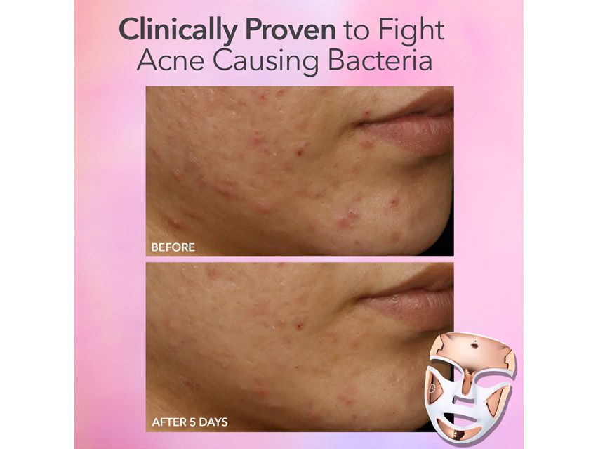 Dr. Dennis Gross Skincare DRx SpectraLite™ FaceWare Pro