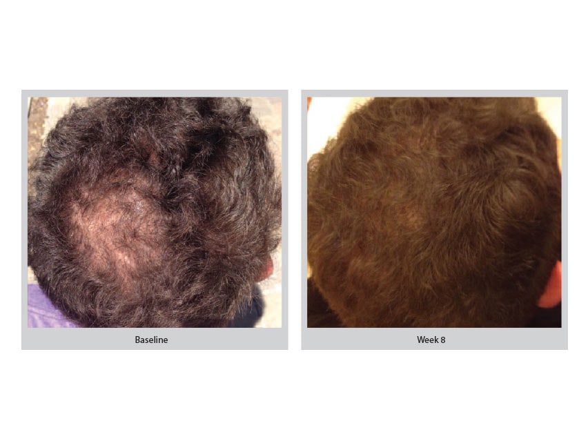 NuGene NuCell Hair Anti-Hair Loss Serum