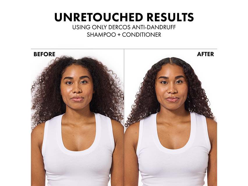 Vichy Dercos Selenium Sulfide Anti-Dandruff Shampoo