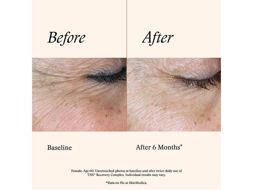 SkinMedica TNS Recovery Complex