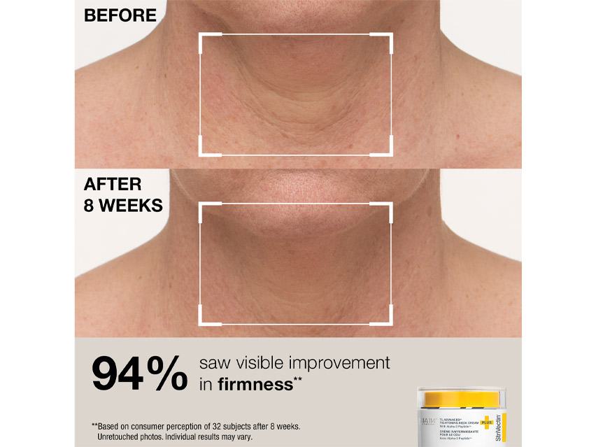 StriVectin Tighten &amp; Lift Face &amp; Neck Solution Set - Limited Edition