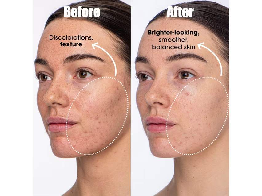 Sunday Riley Detox Darling Pro-Microbiome Balancing Essence