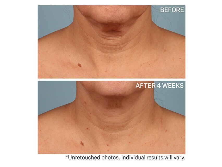 StriVectin TL Advanced Tightening Neck Cream Plus