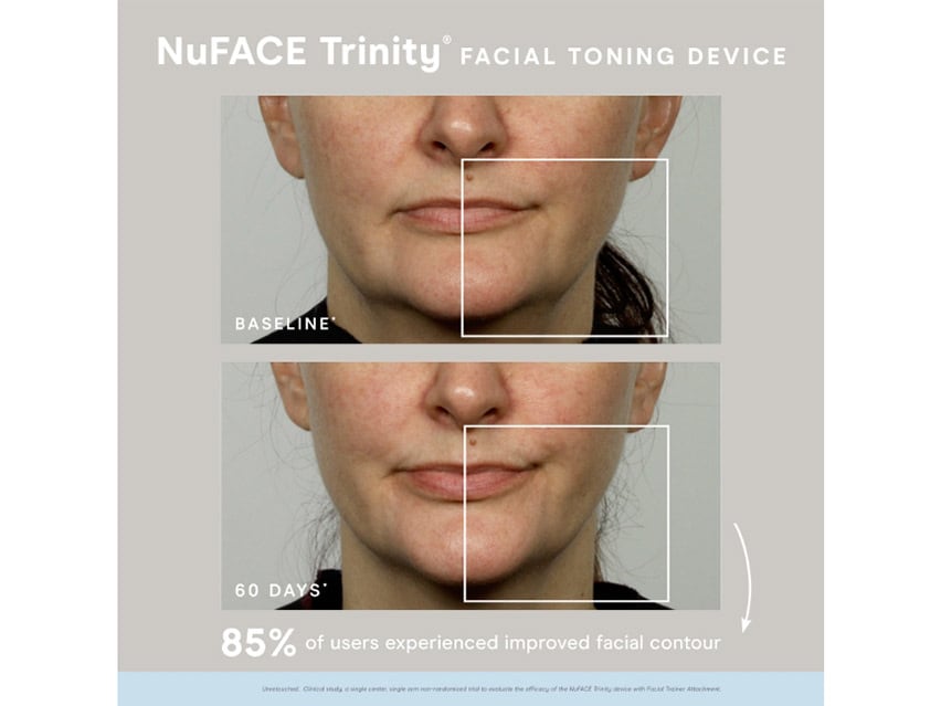 NuFACE Trinity Supercharged Skincare Routine - Limited Edition