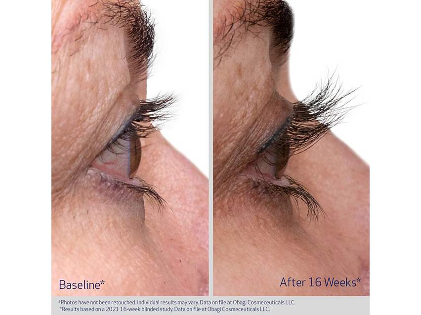 Obagi Nu-Cil™ Eyelash Enhancing Serum