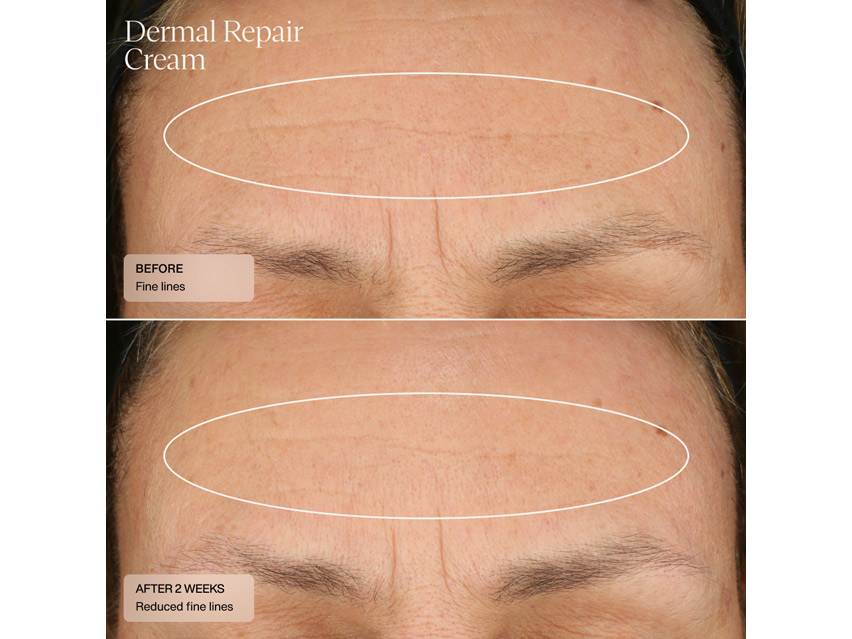 Sent&#233; Dermal Repair Cream &amp; Bio Complete Serum Duo - $203 Value!