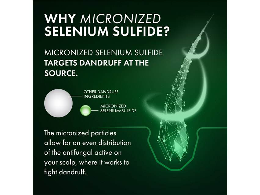 Vichy Dercos Selenium Sulfide Anti-Dandruff Shampoo