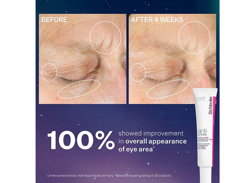 StriVectin Smooth &amp; Plump Anti-Wrinkle Set - Limited Edition