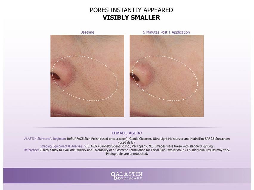 ALASTIN Skincare ReSURFACE Skin Polish