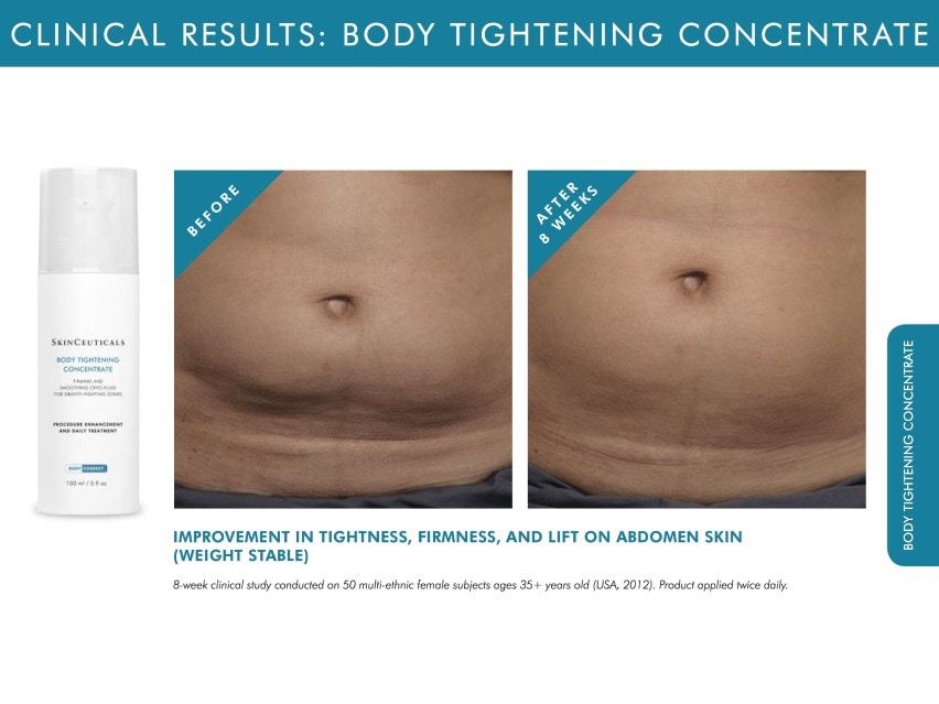 Best Stomach Skin Tightening Cream for Tummy. How to Choose it