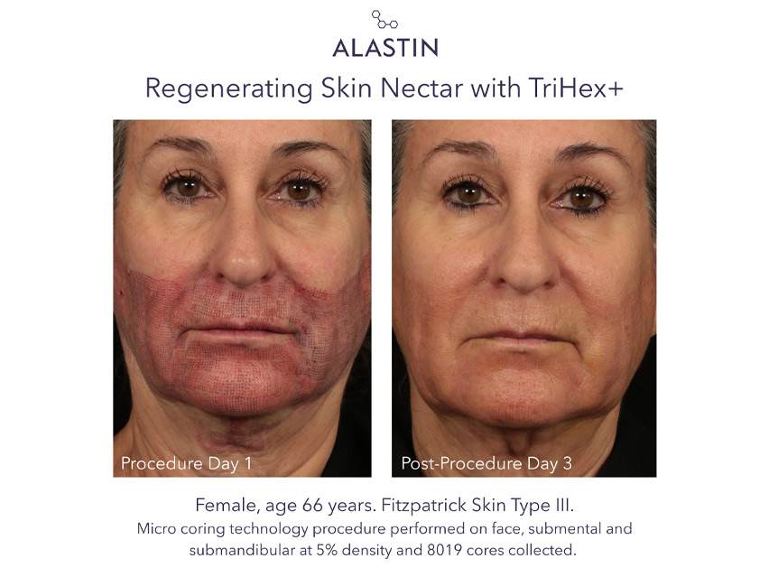 ALASTIN Skincare Regenerating Skin Nectar with TriHex+