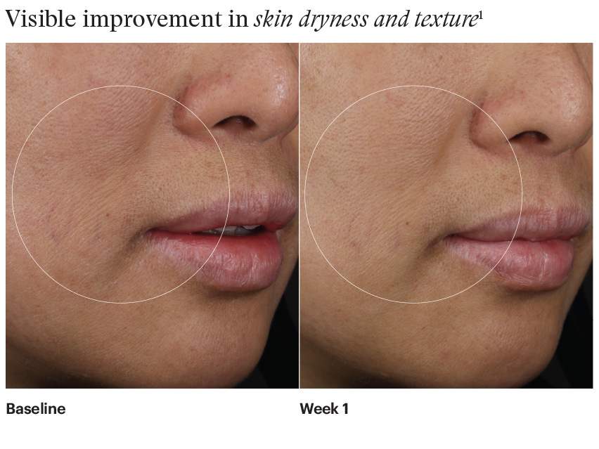 SkinMedica HA5 Hydra Collagen Hydration Regimen