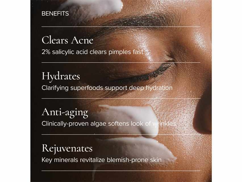 MARA Clear Skin Mineral Milk Acne Treatment