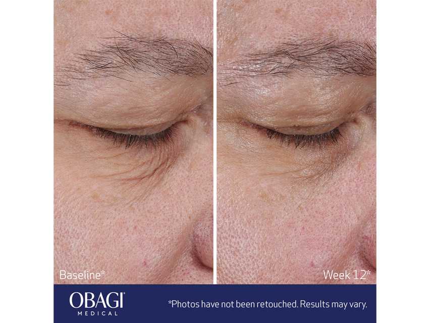 Obagi ELASTIderm Lift Up &amp; Sculpt Facial Moisturizer