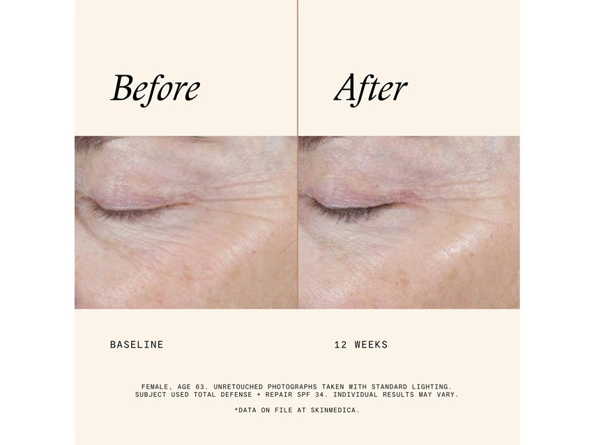 SkinMedica Total Defense + Repair SPF 34 - Untinted