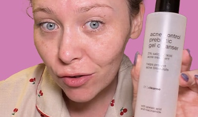 A girl with fair skin and blue eyes holds a bottle of PCA SKIN Acne Control Prebiotic Gel Cleanser.