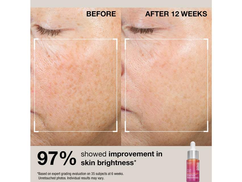 StriVectin Discovery Kit - Limited Edition