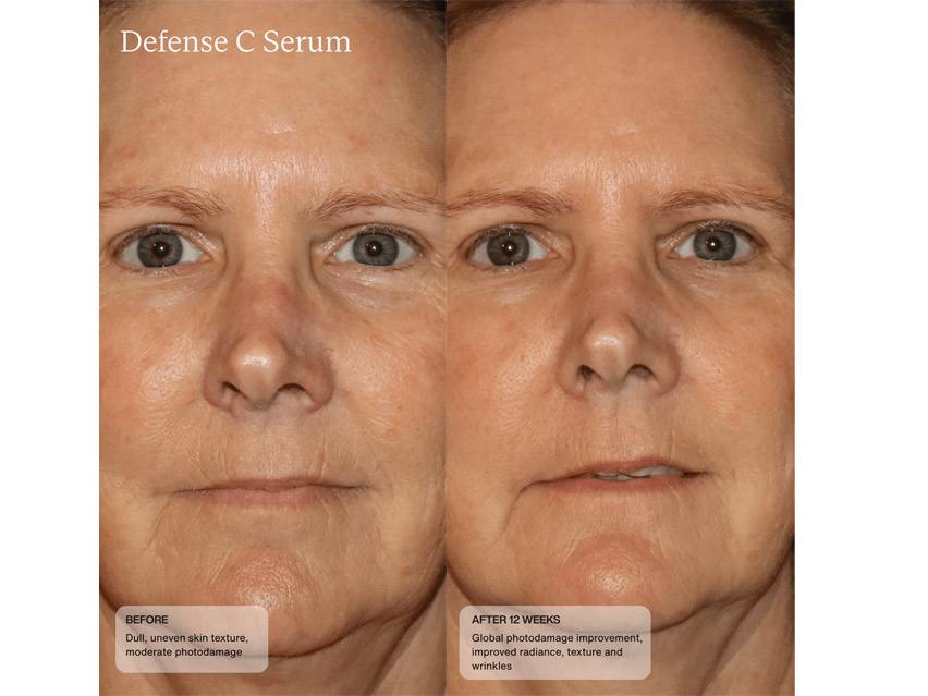 Sent&#233; Defense C Serum with HSA