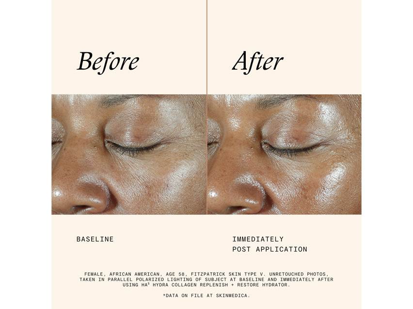 SkinMedica HA5 Hydra Collagen Replenish + Restore Hydrator