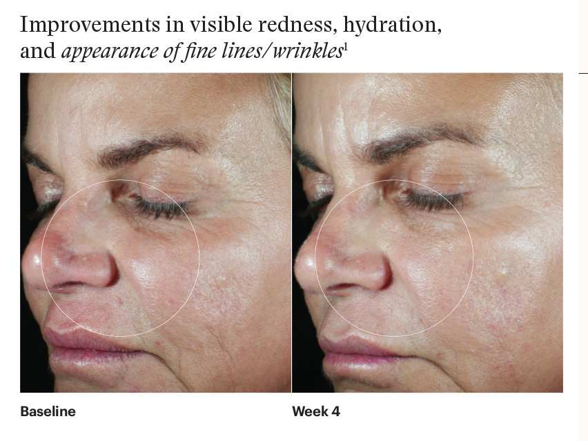 SkinMedica HA5 Hydra Collagen Hydration Regimen